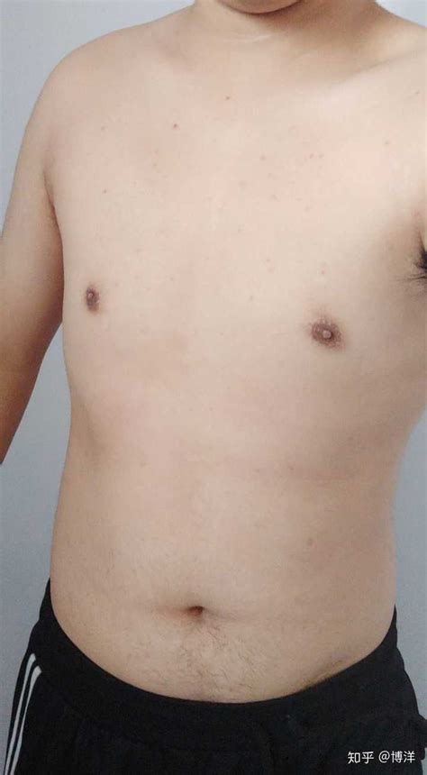 男生胸部長毛|男人乳房周围长毛怎么回事，怎么办